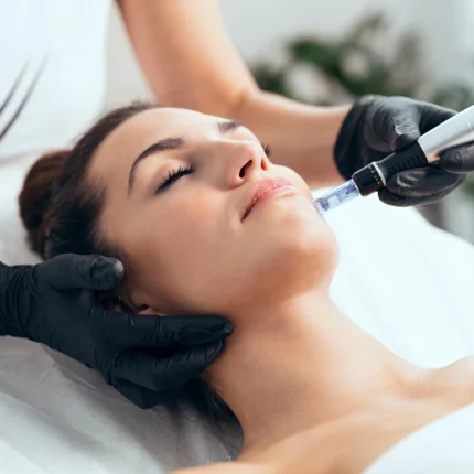microneedling-in-atlantic-beach-ny microneedling-in-atlantic-beach-ny