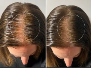 Hair growth Dep Medical(1)