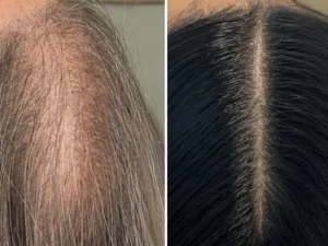 Hair growth Dep Medical(2)