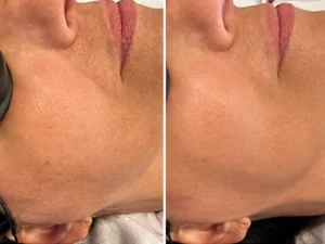 Skingenuity_3